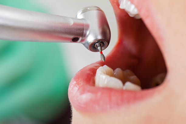 Best Emergency Pediatric Dental Care in New Rockford, ND